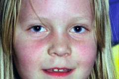 1998-0005-0000-0010-LF1