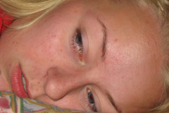 2010-0020-0725-0009-LF1