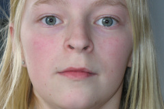 2010-0006-0000-0018-LF1