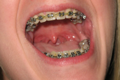 2011-0002-0401-0005-LF1